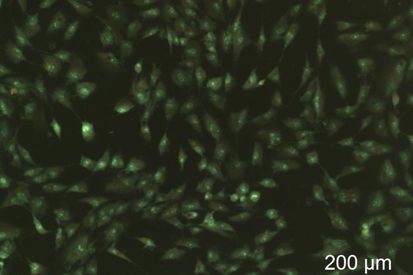  Triušio griaučių raumens kamieninės ląstelės, augančios ant PDMS (polidimetilsiloksano). Žalia spalva indikuoja aukštą ląstelių gyvybingumą (dažyta akridino oranžo-etidžio bromido dažų mišiniu).