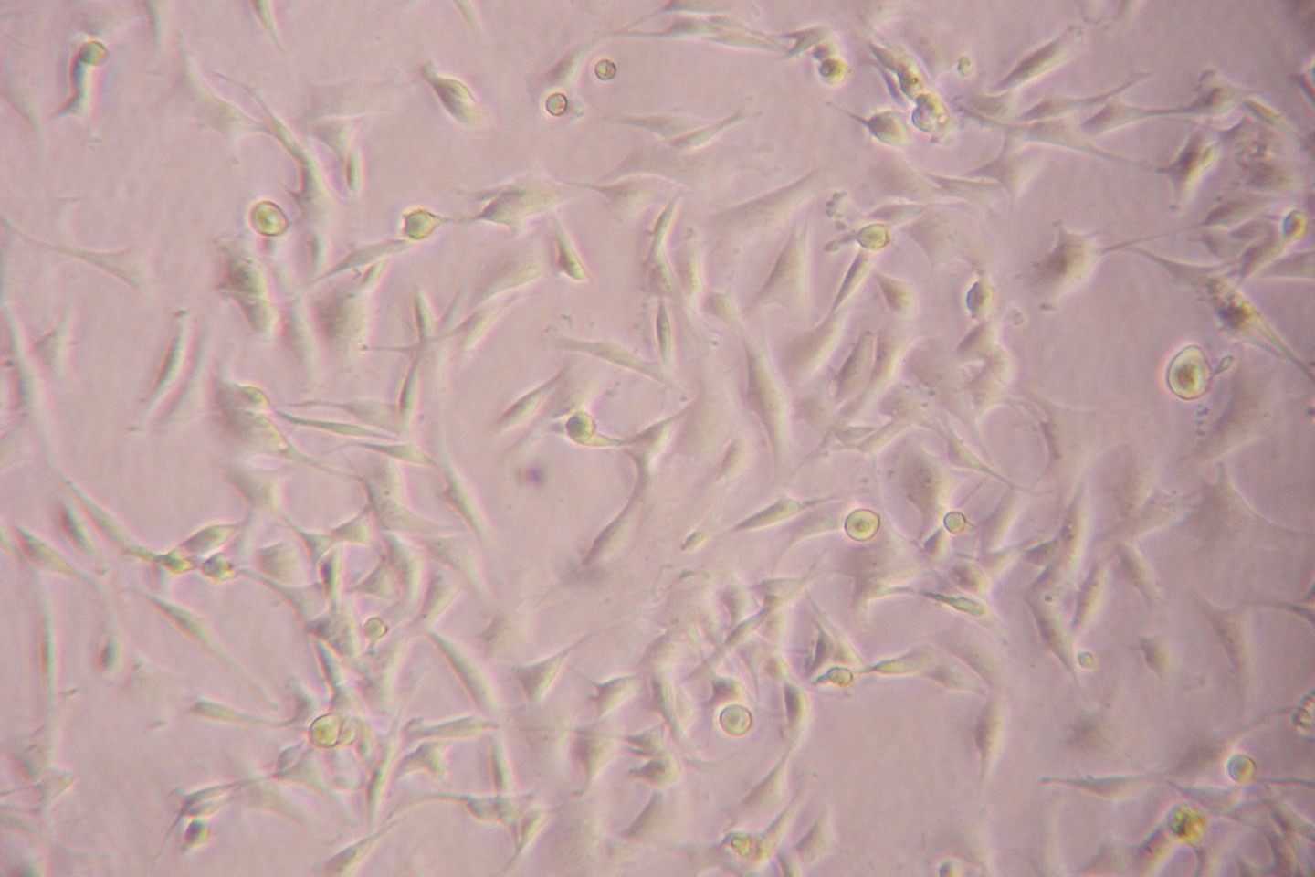  Taip po mikroskopu atrodo iš triušio griaučių raumens išskirtos kamieninės ląstelės.