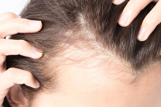 Panaudojusi populiarią plaukų priežiūros priemonę tokio poveikio nesitikėjo