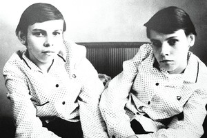 Garsiausių Sovietų Sąjungos Siamo dvynių gyvenimas – kaip siaubo filmas