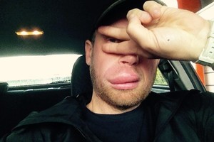 Gurkšnis giros per futbolo varžybas vos nekainavo gyvybės 