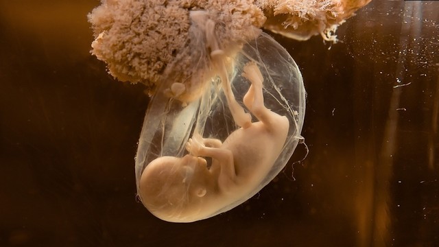 Embrionų laidojimui nepritariantis medikas: „Mes neturime ką duoti“