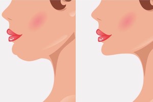 Vargina „dvigubas smakras“? Tai pabandę bemat jį pamiršite!