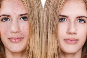 Rudenį odai tenka tikras išbandymas: saugoti reikia ne tik nuo saulės