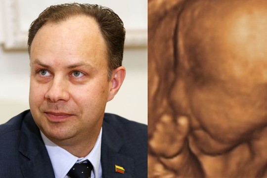 Sveikatos apsaugos ministras Aurelijus Veryga išsakė požiūrį į abortus