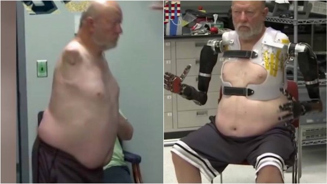 JAV mokslininkai pažangiausiais protezais keičia sužalotus gyvenimus