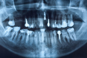 Pasigydžius poliklinikoje teko kreiptis skubios pagalbos