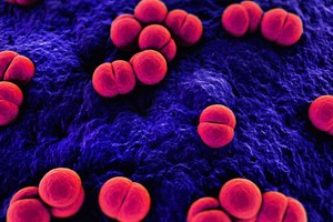 Simptomai panašūs į peršalimo, bet pavojus sveikatai – daug didesnis