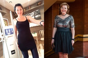 Donalda Meiželytė numetė 10 kg: gyvenimo būde pakeitė vieną dalyką