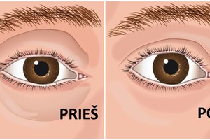 Tai pabandę tamsius paakius pamiršite visiems laikams