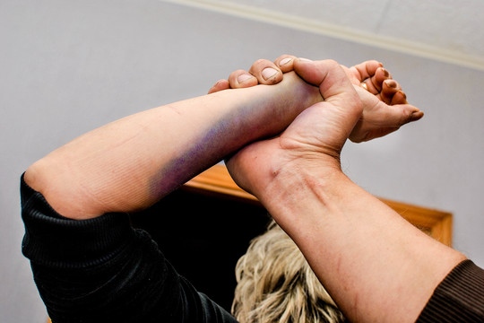 Už neįtikusią vakarienę nuplikė žmoną aliejumi