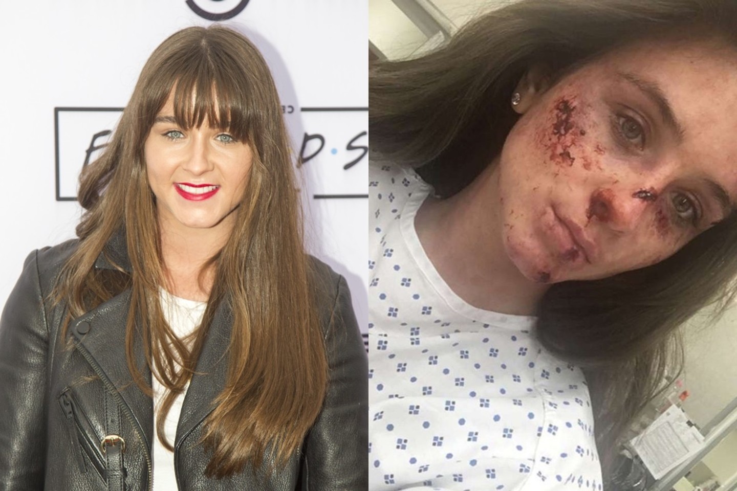 Aktorė Brooke Vincent.