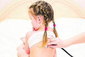 Patarimas: tikrinkite vaikus dėl tuberkuliozės