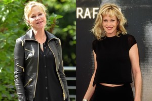 Paniškai bijanti pasenti Melanie Griffith po grožio injekcijų – vos atpažįstama