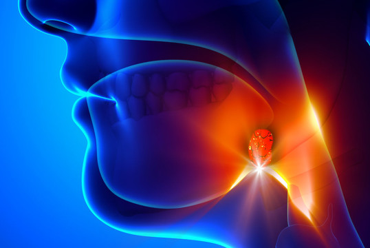 Išvešėję adenoidai: kas tai yra ir kaip gydoma?