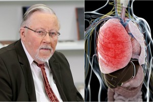 Vytautą Landsbergį užklupusi liga – pavojingesnė, nei manėte
