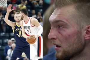 Portlande – Indiana „Pacers“ nesėkmė ir rėžiai ant Domanto Sabonio veido