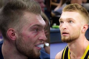 Domantas Sabonis pasisakė apie rungtynėse sudraskytą veidą