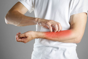 Vilniuje padaugėjo nemalonios užkrečiamosios ligos atvejų