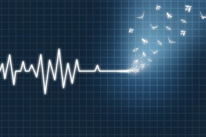 Šiurpokas atradimas: aplinką jaučia ir po mirties