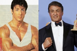 Sylvesterio Stallone išvaizdos pokyčiai: po nevykusių operacijų sensta natūraliai