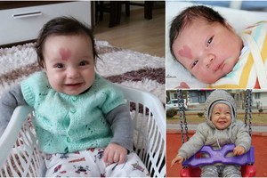 Tikras meilės kūdikis: berniuką garsina neįprastos formos žymė