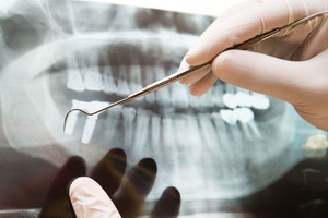 Lietuvis specialistas – tarp pirmųjų Europoje atlikusių sudėtingą operaciją