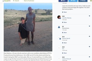 Neįtikėtina meilė: be šlaunų gimusį vyrą pamilo ilgakojė gražuolė