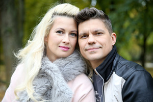 Renata Norvilė ryžosi drastiškoms grožio procedūroms