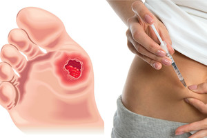 Liga plinta tarsi epidemija: kas dešimt sekundžių pakerta po žmogų, o baigiasi labai liūdnai