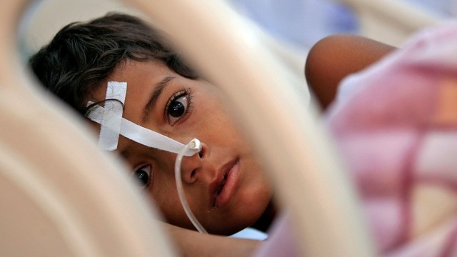 Jemene nuo bado gali mirti iki 7 milijonų žmonių