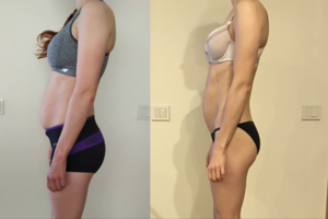 Nereikalingus kilogramus moteris ištirpdė per keletą mėnesių