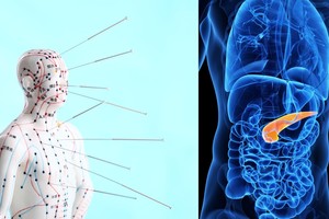 Kelios natūralios priemonės gelbsti nuo epidemija tapusios mirtinos ligos