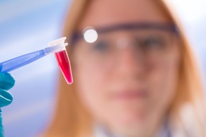 Tikroji padėtis su AIDS Lietuvoje: latviams – dar liūdniau