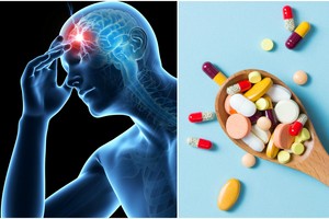 Dėl to kenčia milijonai: rastas būdas galvos skausmus leis pamiršti