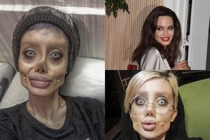 Zombiu virtusi Angelinos Jolie gerbėja paviešino nuotraukas, kaip atrodė anksčiau