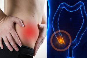 Gyvybiškai svarbu žinoti: 5 požymiai įspėja apie ligą, grasinančią gyvybei