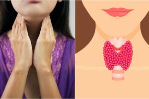 6 maisto produktai, galintys sukelti rimtų sveikatos problemų