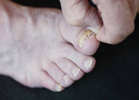 Šiltos avalynės pavojai: niežulys ir nemalonus kvapas – tik pati pradžia