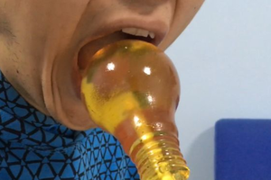 Kinijos gydytojai perspėjo nesivaikyti pavojingos naujos mados