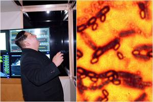 Korėjos pusiasalyje – Pchenjano ir JAV bandymai paversti juodligę ginklu