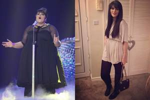 190 kg svėrusi „Britanijos talentų“ žvaigždė drastiškai atsikratė pusės svorio