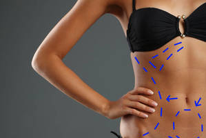 Naujametiniai pažadai: dominuoja noras įveikti kompleksus