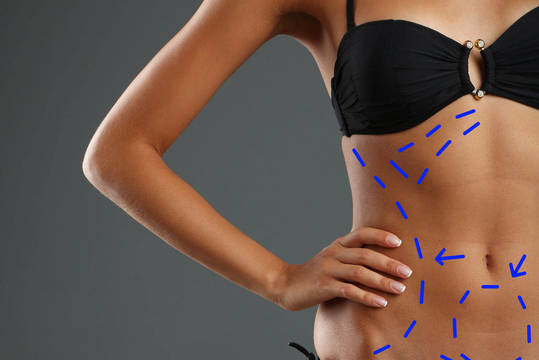 Naujametiniai pažadai: dominuoja noras įveikti kompleksus