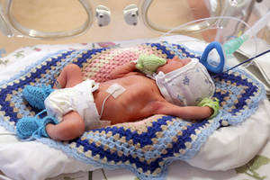 Užstojo ligoninėje atsidūrusio veganiškai maitinto kūdikio mamą: „Problema kita“ 