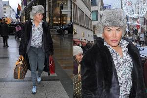 Lėlė Kenas nesiliauja stebinti: pasidarė itin pavojingą operaciją 