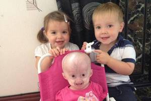 Užgeso daugybei žmonių viltį įžiebusios mergaitės gyvybė