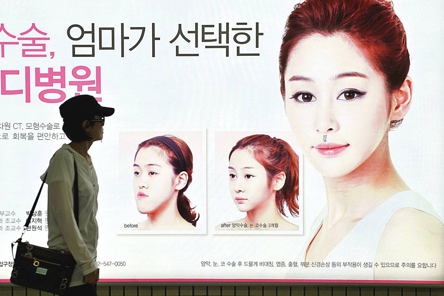 Seule plakatų, reklamuojančių plastines operacijas, yra beveik ant kiekvieno kampo. Tiesa, dėl milžiniškos operacijų paklausos atsiranda daugybė padėtimi norinčių pasinaudoti chirurgų apsišaukėlių.