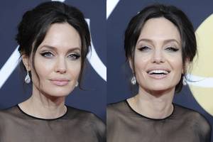 Visagalis botoksas: Angelina Jolie pasirodė bent dešimtmečiu atjaunėjusi