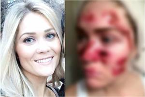 Pasidalino itin nemalonia akimirka: taip gali nutikti visiems